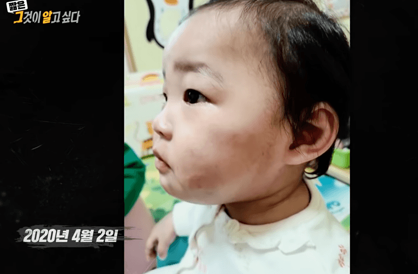 韩父母虐死1岁女儿，踩到胃破骨碎！20万人请愿，文在寅发声