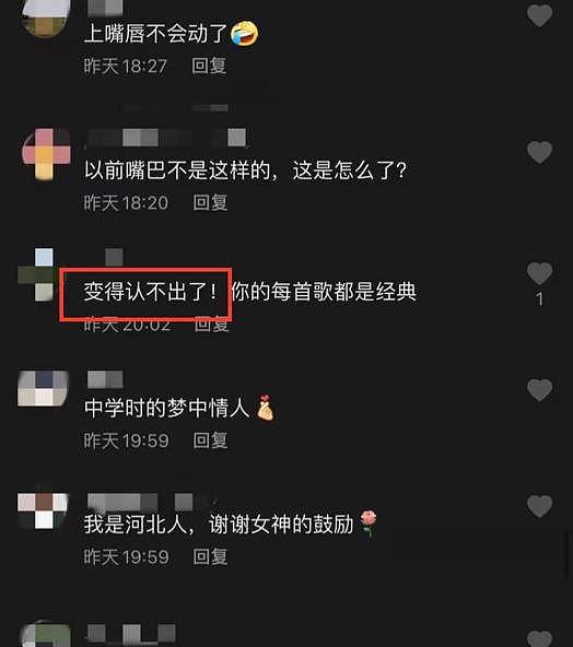 怎么了？51岁孟庭苇满口牙东倒西歪，脸部僵硬说话张不开嘴（视频/组图） - 4