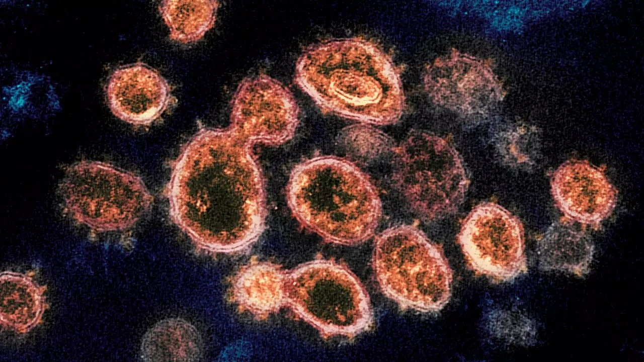 美国国家过敏和传染病研究所-落基山实验室提供的2020年电子显微镜图像显示的新冠病毒颗粒。