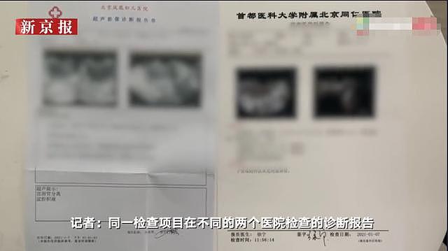 “3万能治的病花33万”！北京一医院被举报后：院方联系患者协商，涉事医生已停职（组图） - 19