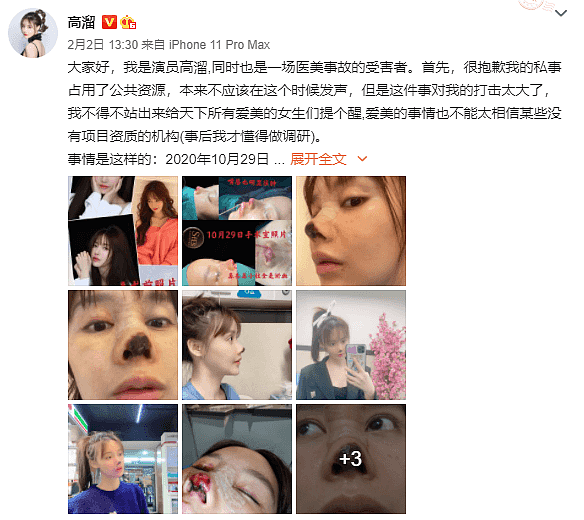 中国女星整容失败引澳媒关注，西人网友纷纷留言表同情！“之前就很美，可怜的姑娘”（组图） - 2