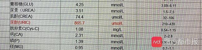 尿酸超标近一倍！25岁中国小伙膝关节里能挤“牙膏”，只因为平时做这件事（组图） - 1