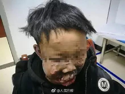 化粪池旁6岁女孩惨死，刷爆朋友圈的这个美丽杀手，不能再碰了！（组图） - 7