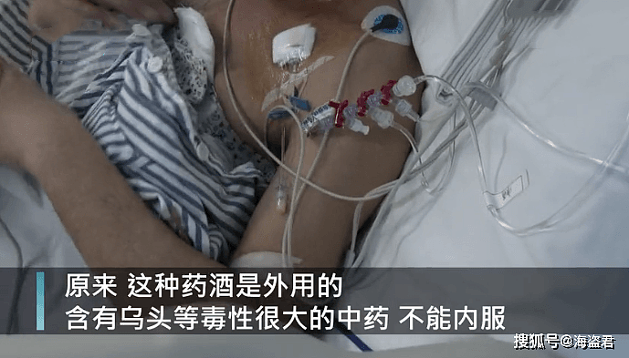 中国男子喝了一杯老乡珍藏的药酒，直接被送进ICU！医生：遇此情况请尽快送医（组图） - 5