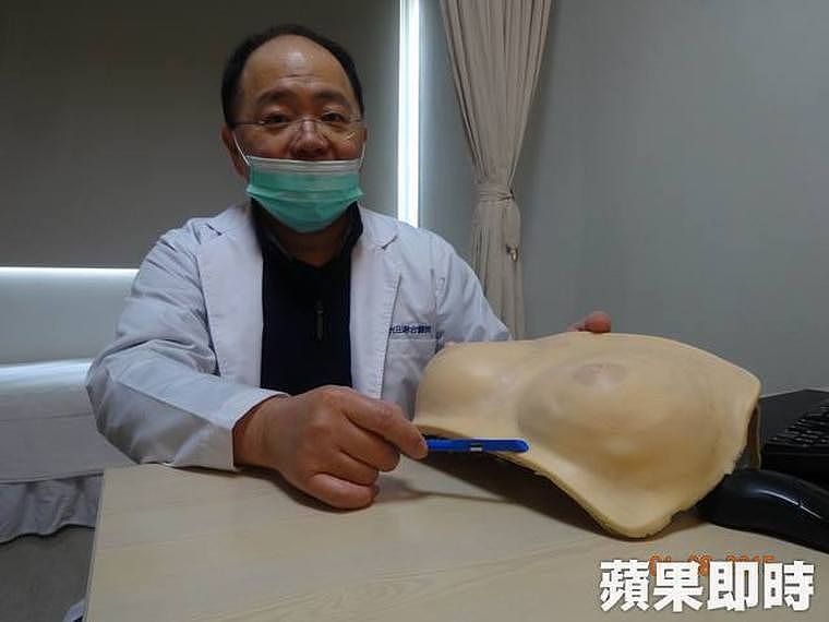 郝治华医师解说「皮下肿胀乳房手术」。 光田医院提供