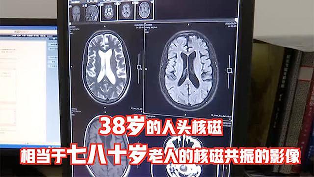 没有性生活，38岁男子因梅毒导致“痴呆晚期”，医生：这些行为要小心！（组图） - 1