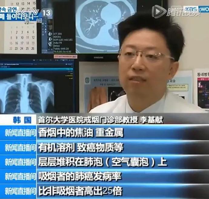 打开死者的器官，才明白有无数人在悄悄花钱买死（视频/组图） - 5