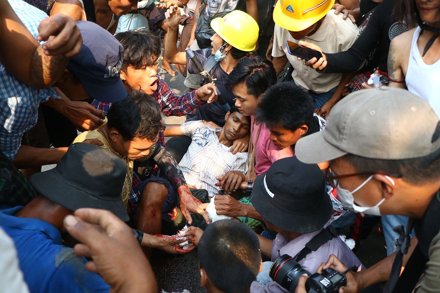 2021年3月14日，在缅甸仰光，反政变抗议者救助一名受伤的男子。（AP）