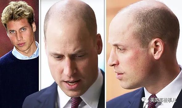 威廉王子被评为全世界最性感秃头？! 网友：他根本不配