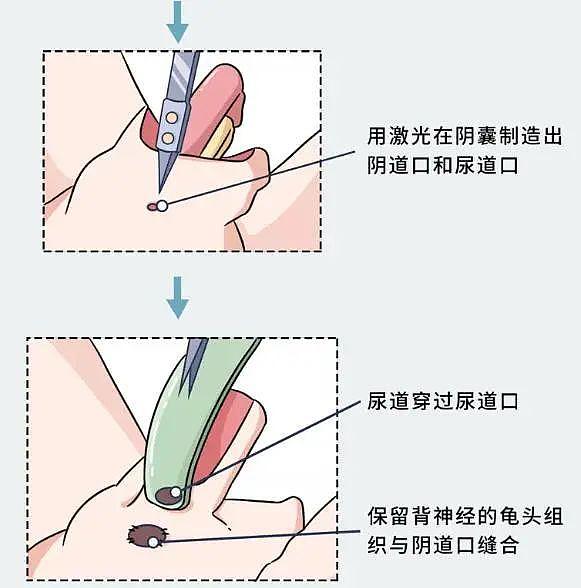 网红Abbily承认未做手术仍是男生：变性手术的可怕，不仅仅是蛋痛（视频/组图） - 8