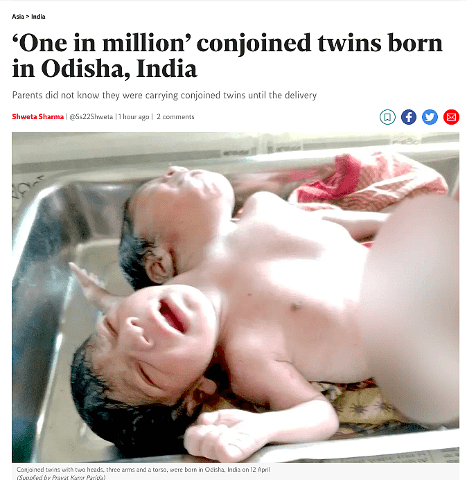 印度一名女子近日产下一对有着2个头、3只手的连体双胞胎。 (取材自独立报)