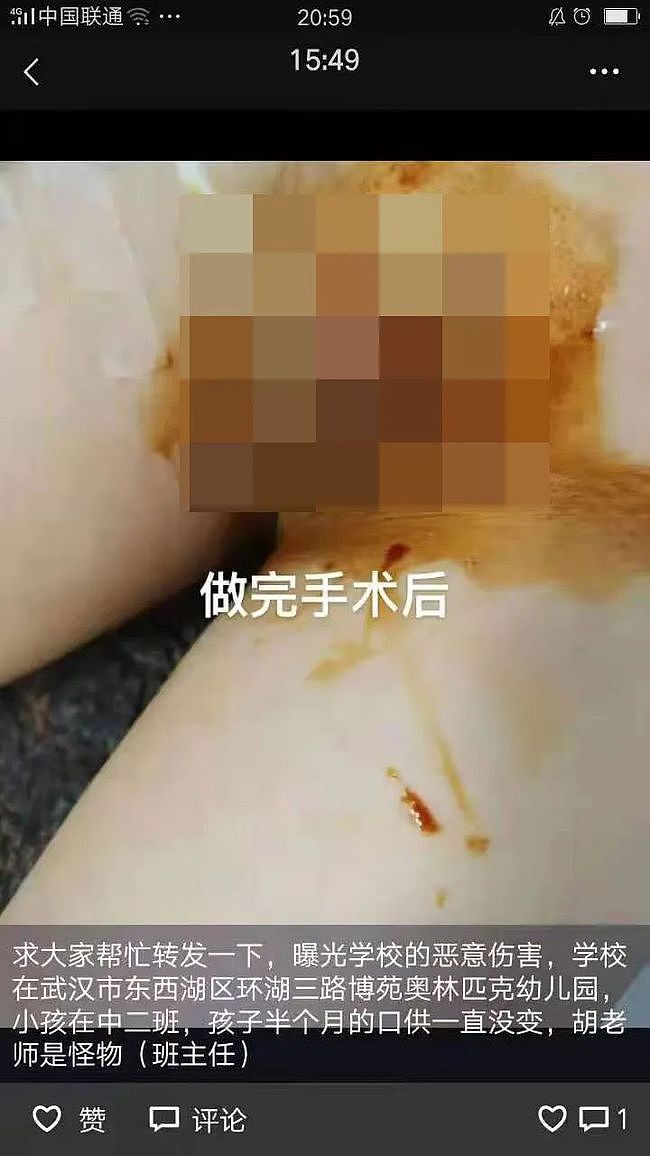 惨叫连连！中国男童生殖器疑遭幼儿园老师剪伤，鲜血直流受伤严重，惨不忍睹（视频/组图） - 4