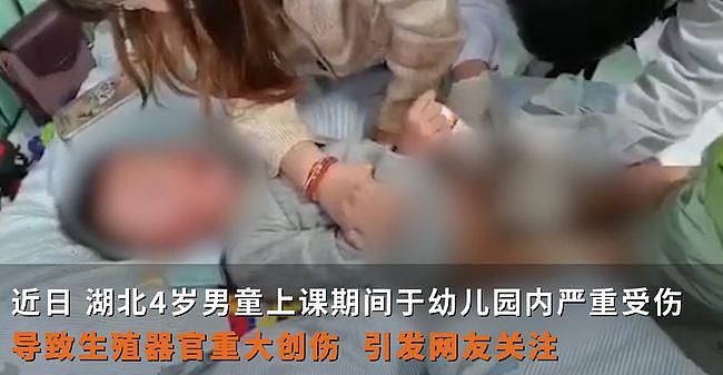 惨叫连连！中国男童生殖器疑遭幼儿园老师剪伤，鲜血直流受伤严重，惨不忍睹（视频/组图） - 1