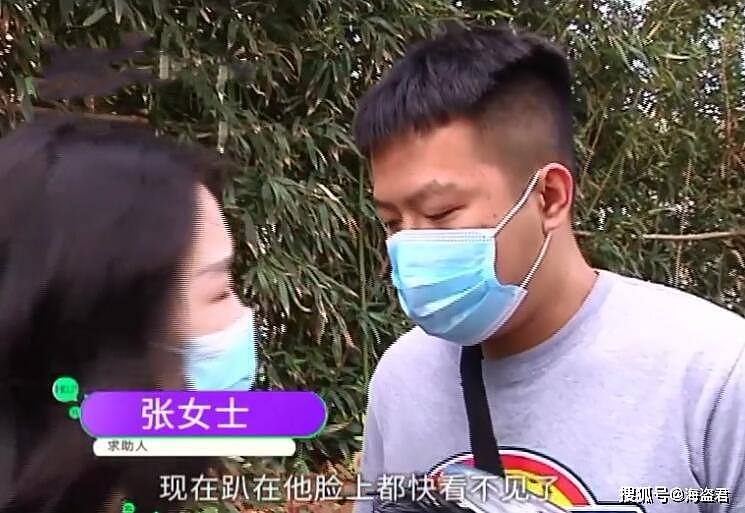 中国男子三星手机爆炸，女友崩溃：现在趴他脸上都看不见睫毛了（视频/组图） - 9