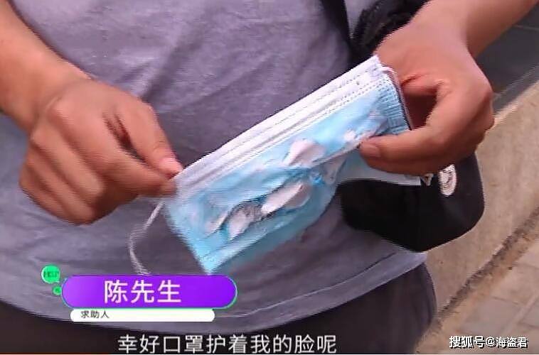 中国男子三星手机爆炸，女友崩溃：现在趴他脸上都看不见睫毛了（视频/组图） - 10