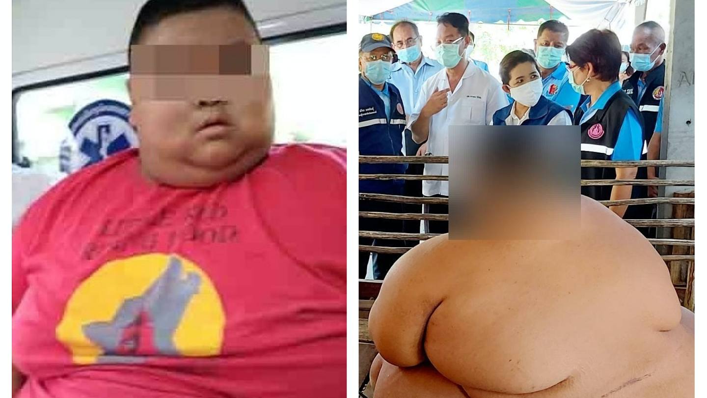 泰国男童13岁体重200公斤，胖得走不动！背后是悲惨身世（组图） - 1