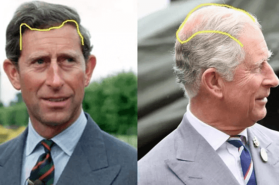 王子是“秃头”，公主是凸嘴龅牙，英国王室的基因是被谁带跑偏的（组图） - 9