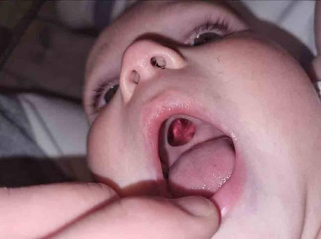 英国年轻妈妈发现宝宝上颌有个洞，吓得痛哭流涕结果虚惊一场（组图） - 1