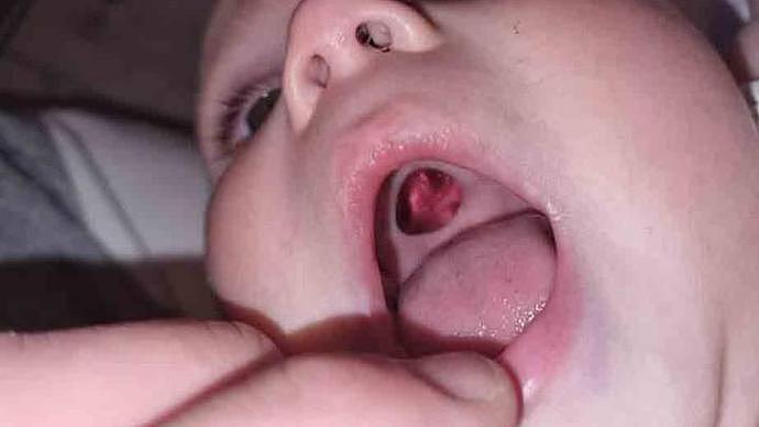 英国年轻妈妈发现宝宝上颌有个洞，吓得痛哭流涕结果虚惊一场（组图） - 4