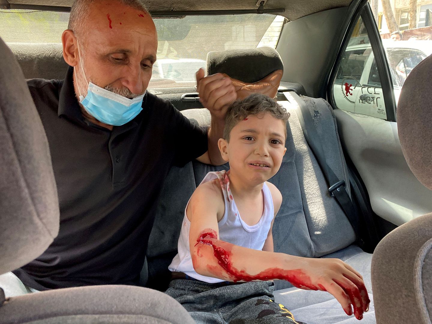 5月11日，在以色列的反击中，一名巴勒斯坦儿童受伤。（Reuters）