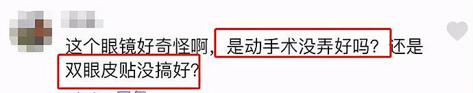 玖月奇迹王小玮近照曝光！双眼皮怪异被疑动刀，其外貌引起网友热议（组图） - 3