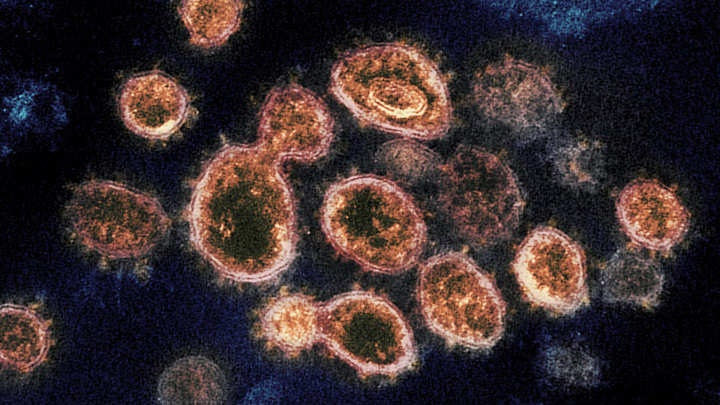 世卫组织要求意大利重新检验2019年疑似病毒样本（组图） - 1