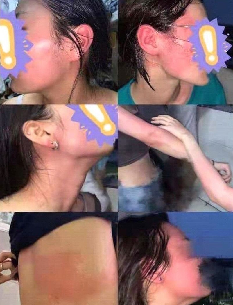 网上热传学生被殴的相片。