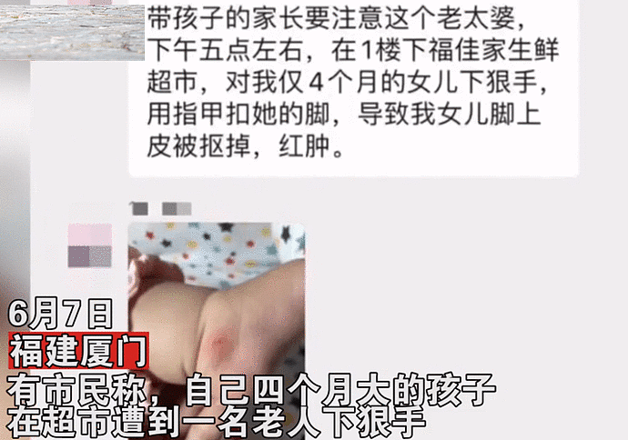 下手真狠！4个月大的女婴超市内遭中国大妈狠掐，婴儿脚被掐掉一块皮嚎哭不止（视频/组图） - 3
