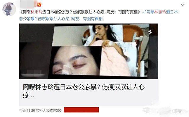林志玲老公晒视频庆出道16周年，此前被传家暴（组图） - 6