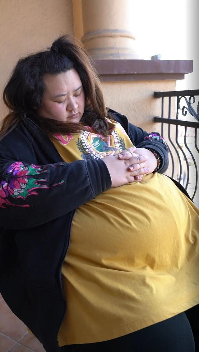 29岁女大学生被杨天真“安利”切胃手术！减重80斤，人却快不行了（组图） - 3