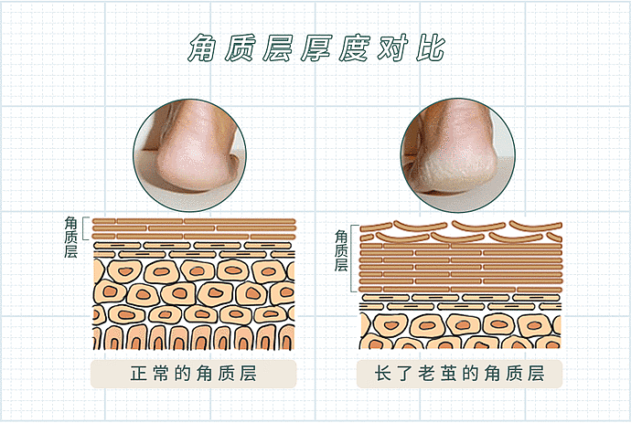 为啥女孩子的身体，都是白白嫩嫩滑滑的啊？（组图） - 18