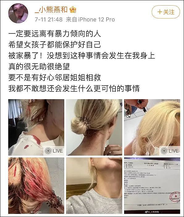 杭州一知名网红博主自曝被男友家暴，头部大量出血！警方发布通报：行拘七日，罚款二百