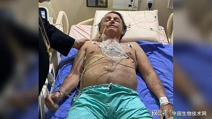 巴西总统博索纳罗因连续十天打嗝紧急住院，或需要手术！医生：可能很严重（图） - 1