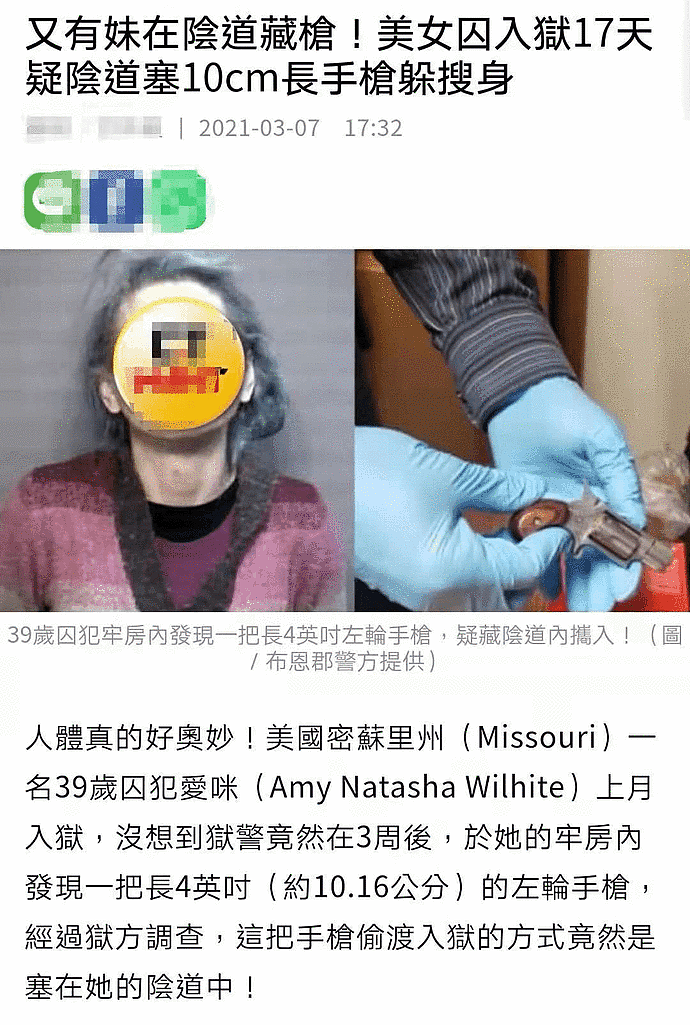 阴道里塞手枪算啥，我还见过更奇葩的：拿黄瓜清洁、异物的种类多种多样！（组图） - 1