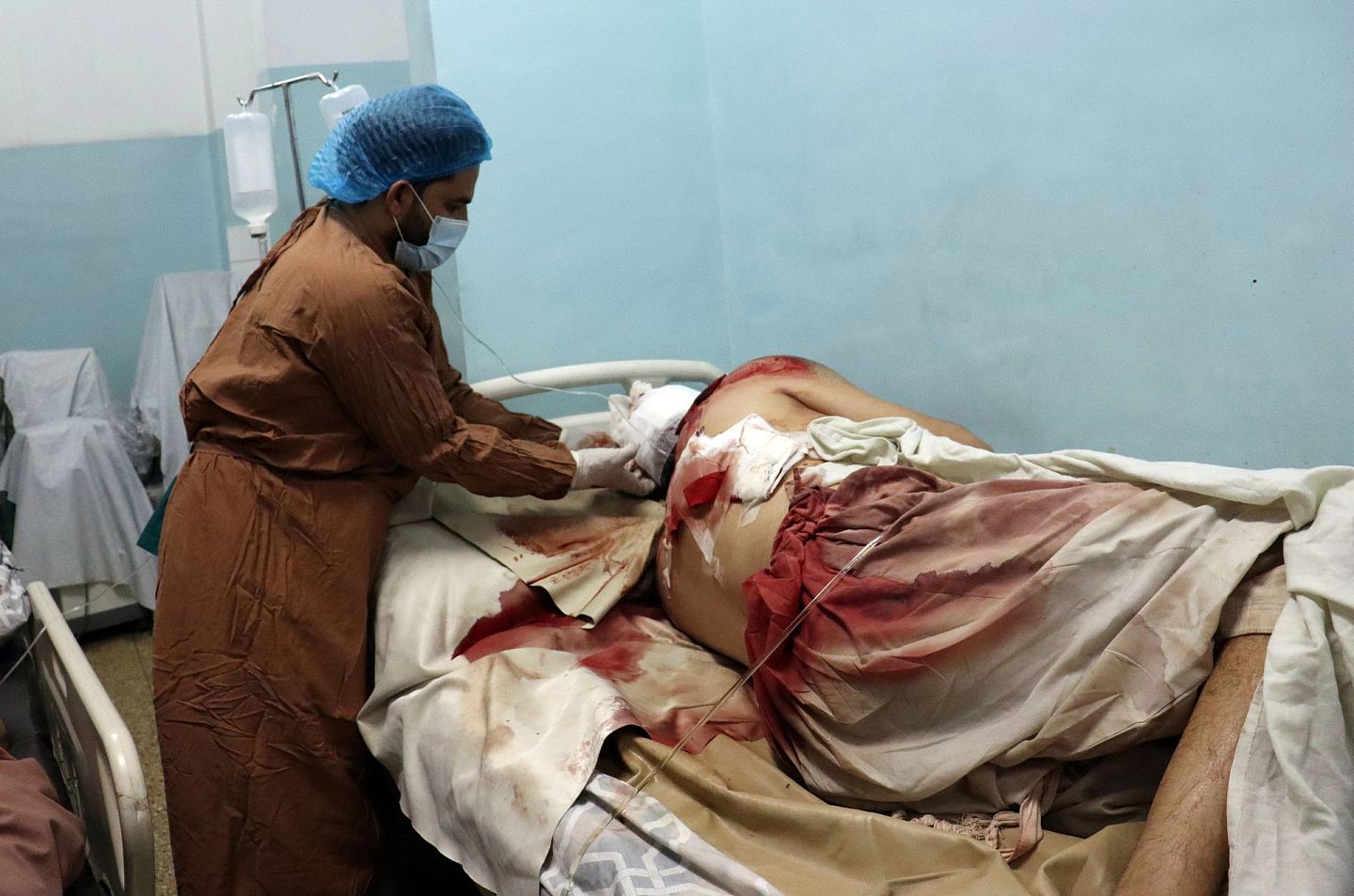 8月26日，一名受害者在阿富汗喀布尔机场外的致命袭击中受伤后，在医院接受治疗。（AP）