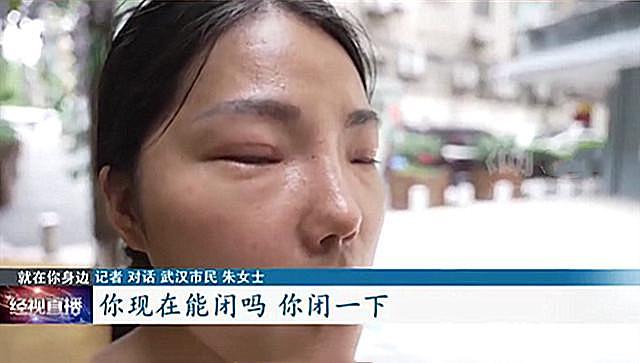 武汉女子整容失败，说好整成“舒淇”同款鼻，结果连微笑都成问题（组图） - 2