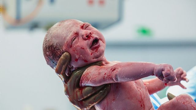 Baby being delivered with eyes semi-open and covered in liquid