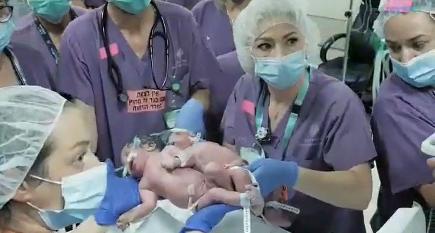 医学专家商讨为连体婴进行分离的过程（FB@סורוקה- מרכז רפואי אוניברסיטאי）