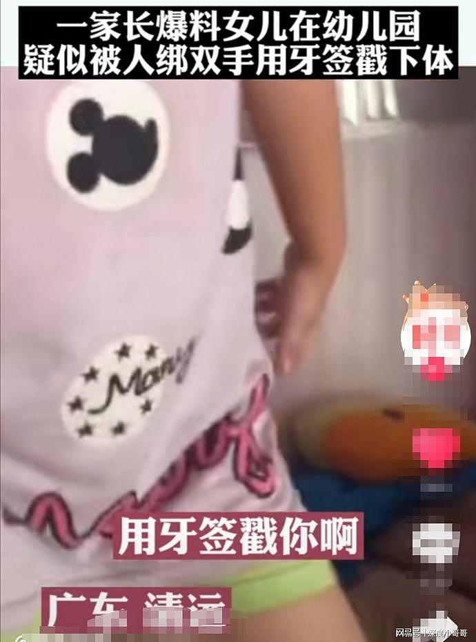 幼儿园女童曝遭老师侵害：手脚遭捆绑，脱裤子用牙签狠戳下体，妈妈：心都碎了！（组图） - 3