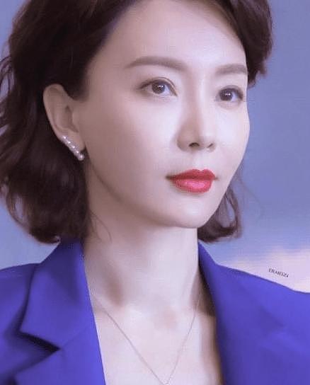 做了颧骨内推的明星真的变美了吗？推平容易后悔难，后遗症竟然一大堆！（组图） - 20