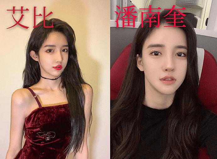 做了颧骨内推的明星真的变美了吗？推平容易后悔难，后遗症竟然一大堆！（组图） - 35