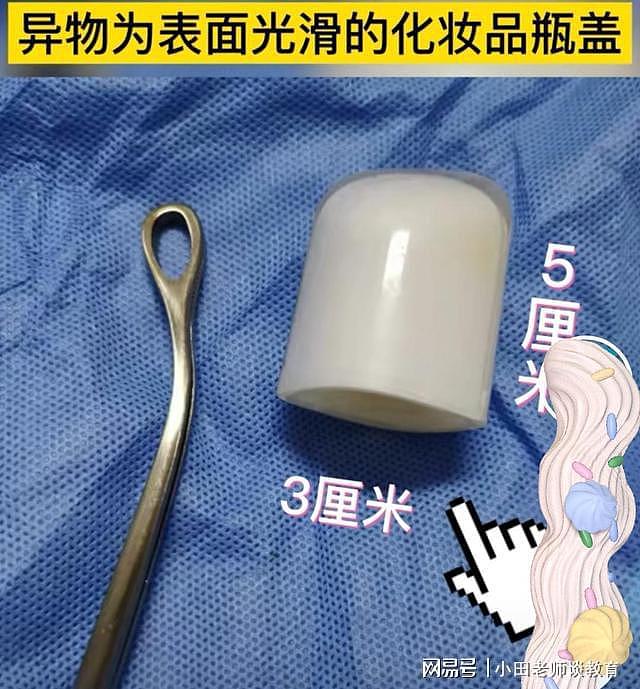 19岁女学生和男友寻求“刺激”，直径3cm异物塞入下体一个月！网友：玩得花（组图） - 2