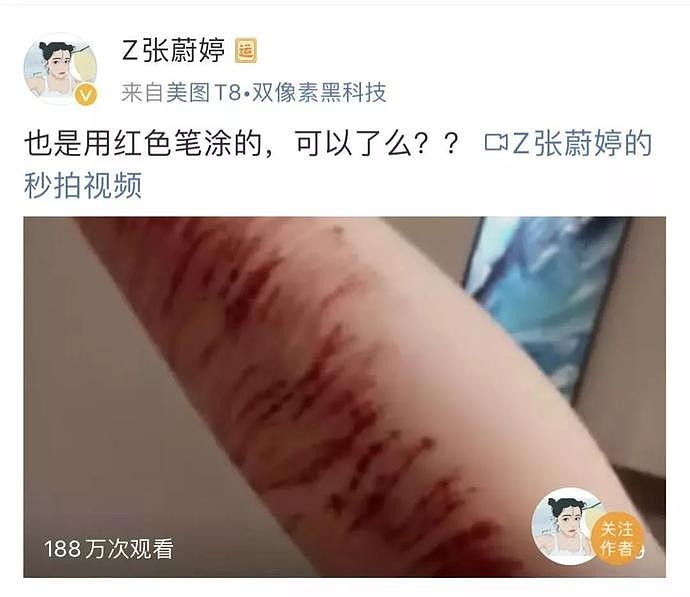 女孩举报称遭房东性侵，男方母亲扇她耳光：你又不是处女，睡一下怎么了！（组图） - 4