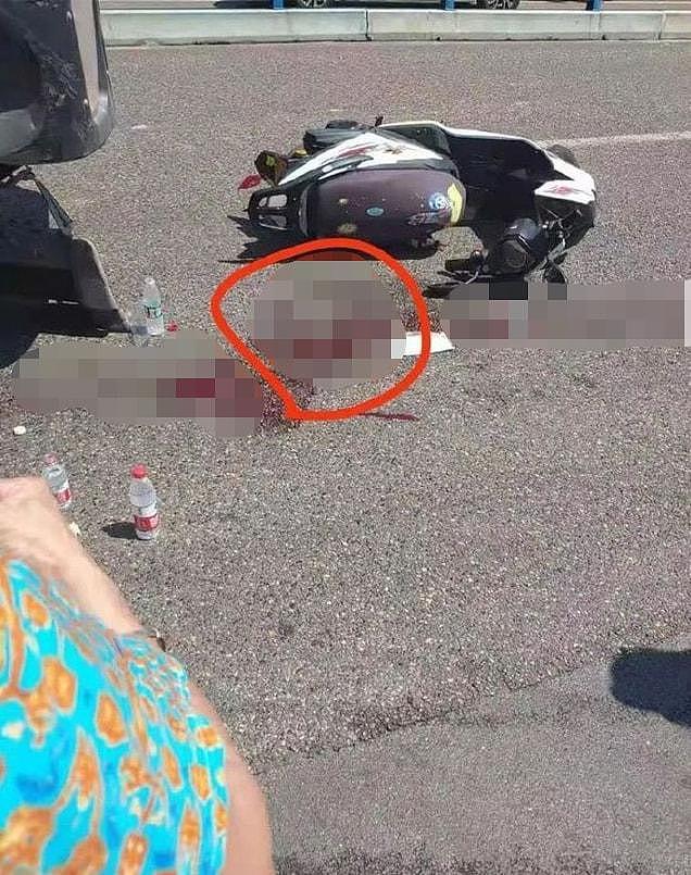 摩托车祸撞飞“蛋蛋”，两颗睾丸散落滚烫柏油马路上，还能再移植回去吗？（视频/组图） - 3