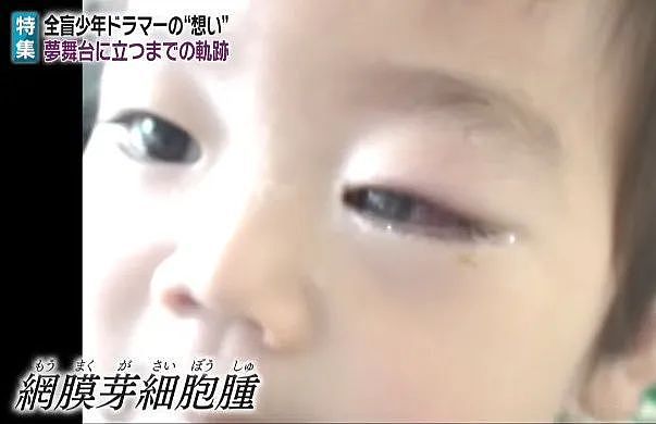 日本少年2岁摘双眼，10岁成为人气爱豆，今上奥运舞台（组图） - 3