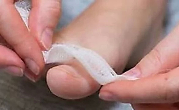 If You Have Nail Fungus, Do This Immediately (Genius!)