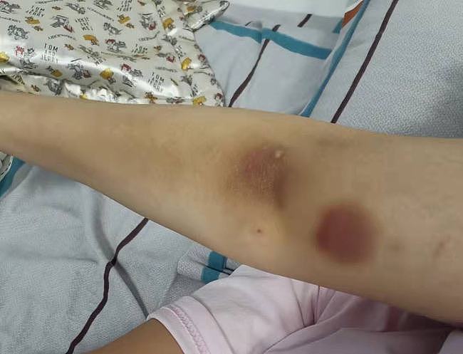 遭遇车祸、高位截瘫的中国留学女孩，拿下了乒乓球冠军（组图） - 6