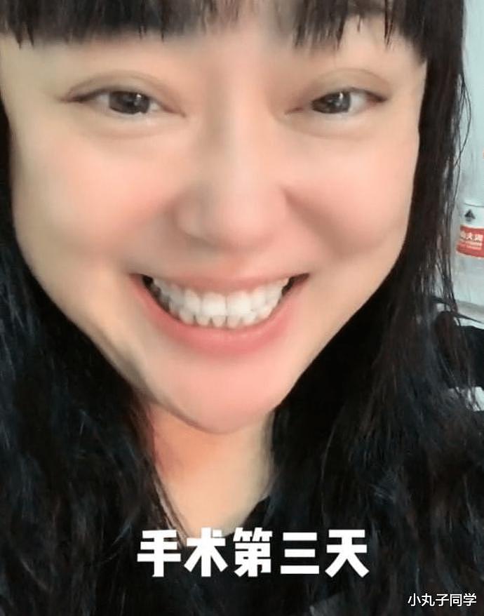 51岁知名女星李菁菁患癌现身医院以泪洗面，疯狂掉发，身体虚弱（组图） - 4