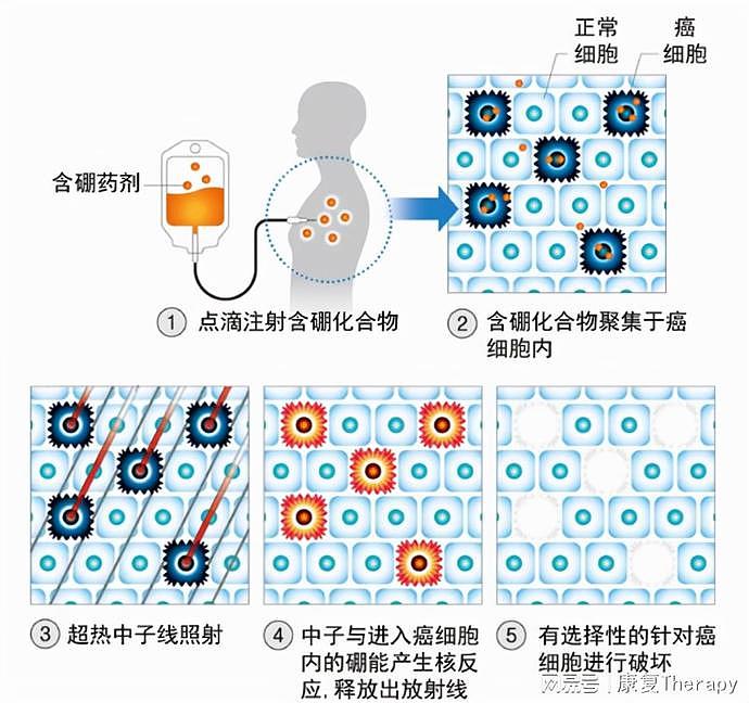 最快30分钟治愈癌症！中国首款“肿瘤核弹”完成中试，价格很亲民（组图） - 3