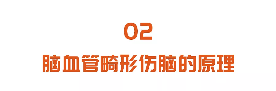 这5个症状，是脑血管“崩溃”的前兆！没有三高的人，也要当心